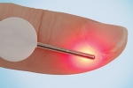 lightneedle_laserneedle_finger