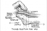 vas_examination_zones
