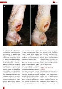 vetcase - leczenie_zakazen_i_ran_wylacznie_poprzez_laseropunkture_02